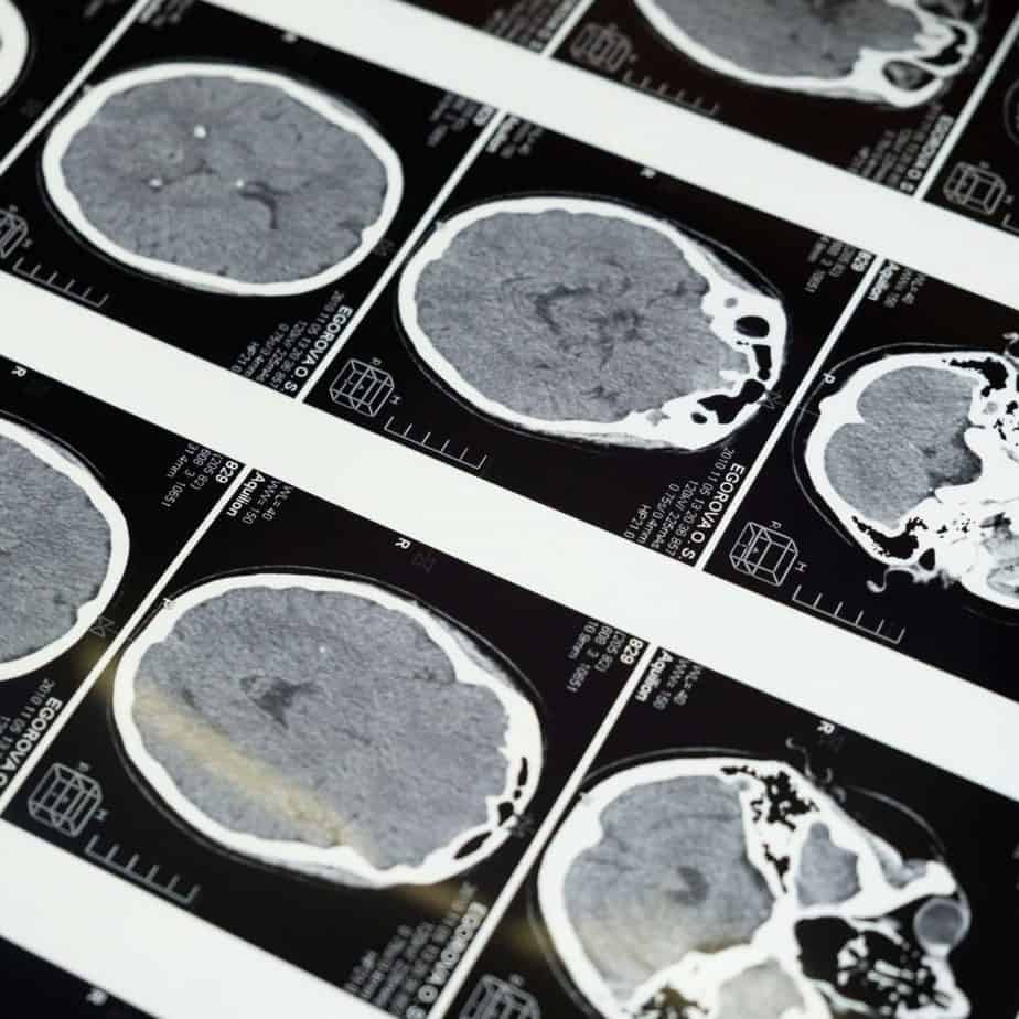 Imaging Imaging