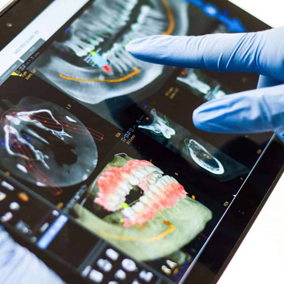 Implant Implant