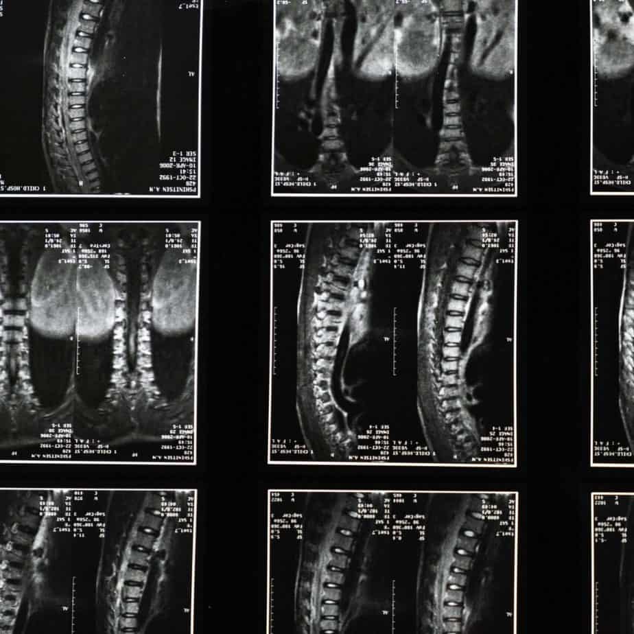 neurobiology expert testimony