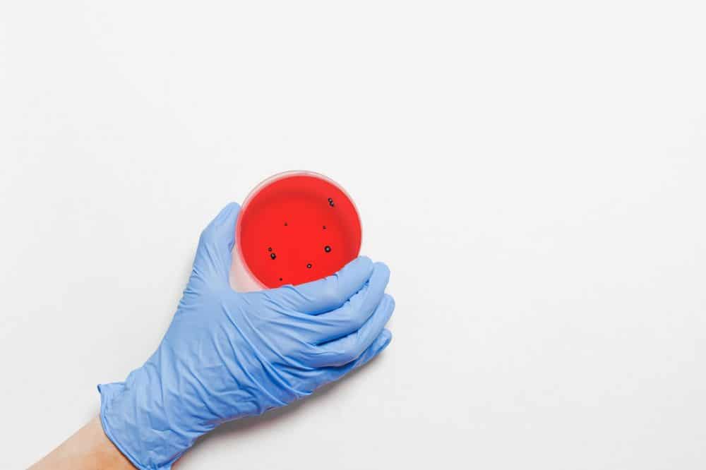 listeria expert testimony