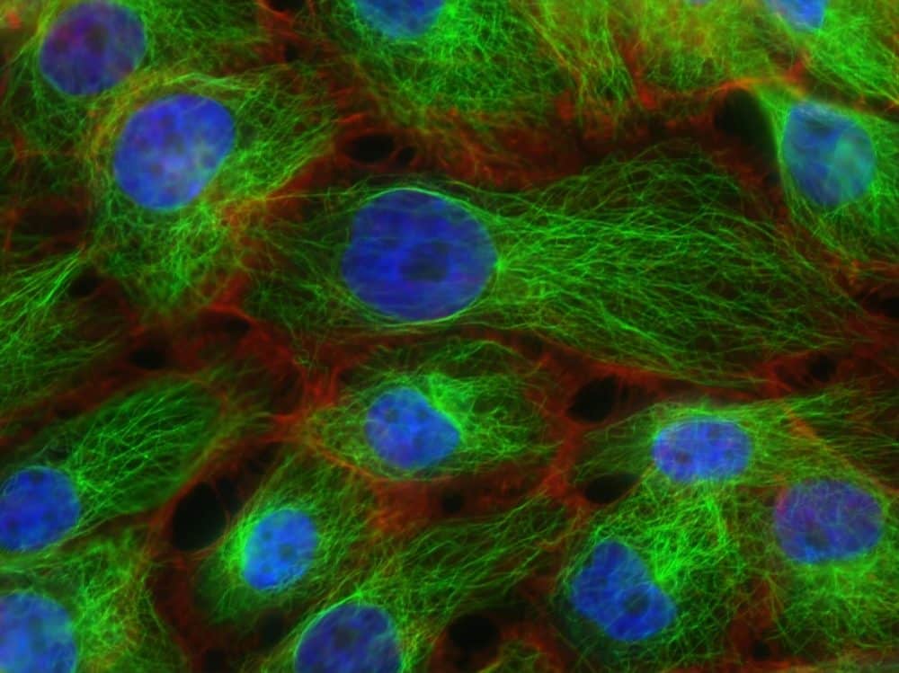 cell therapy expert testimony