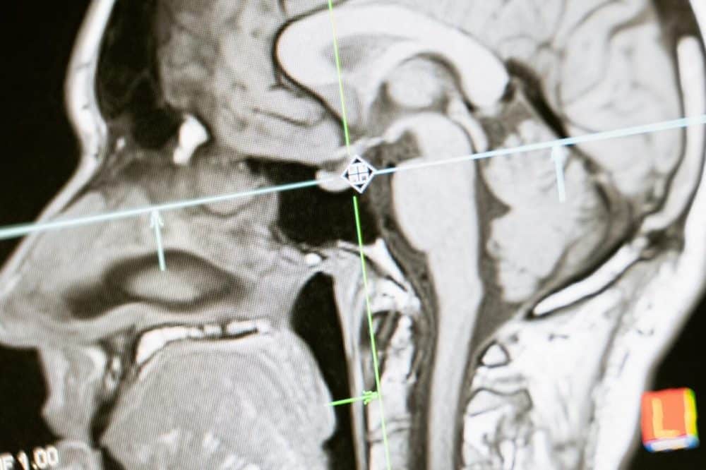 computerized axial tomography cat scan expert testimony
